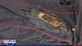 Virginia woman badly burned by vaping device, airlifted to hospital, police say