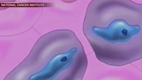 New immunotherapy shows promise