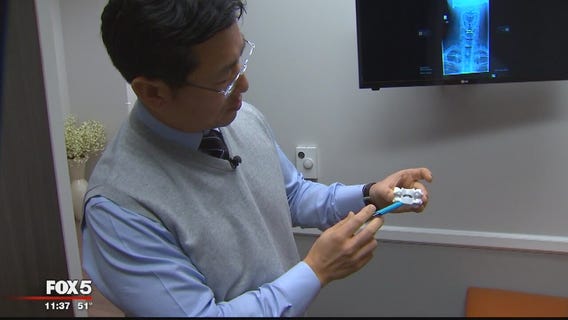 Fairfax County doctor using new technique to decrease chances of opioid addiction