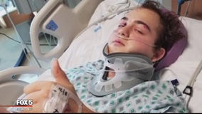 Virginia teen undergoes 4th surgery after hit-and-run crash where he was thrown off Manassas bridge