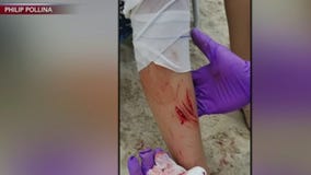 Fire Island shark attacks