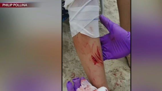 Fire Island shark attacks