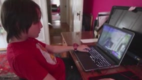 Remote learning and vision concerns