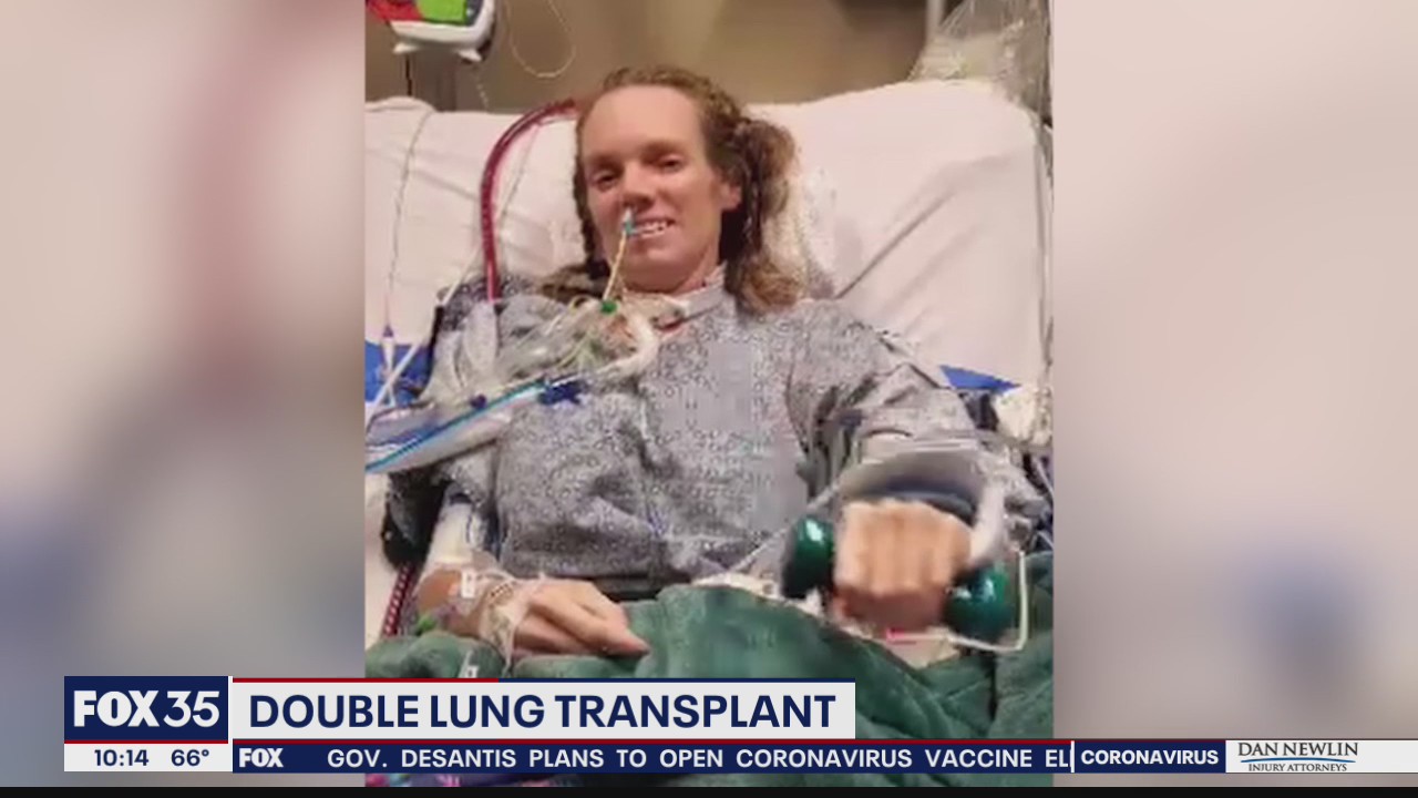COVID-19 survivor receives double lung transplant at UF Health