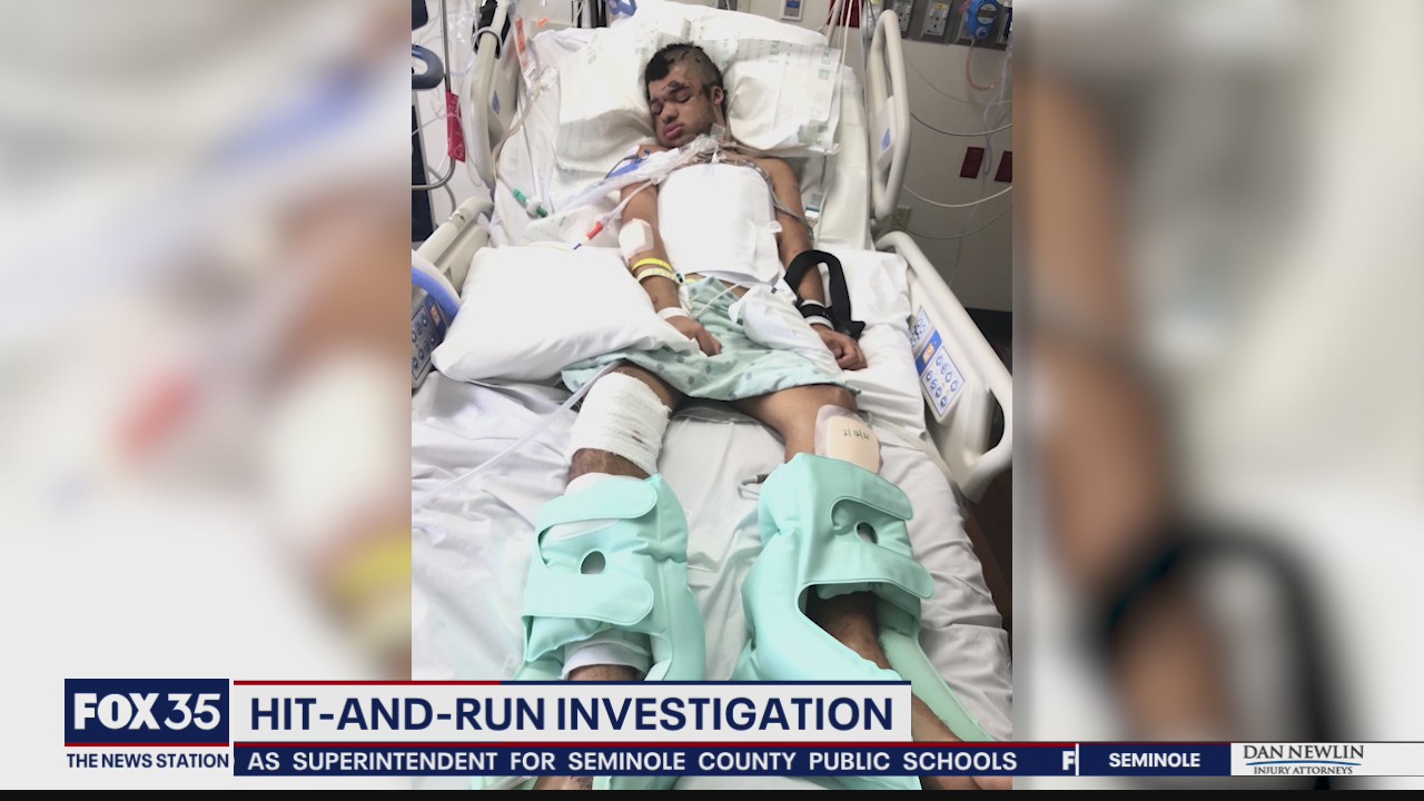 Hit-and-run leaves man on life support