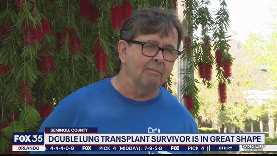 Double lung transplant survivor climbing to recovery