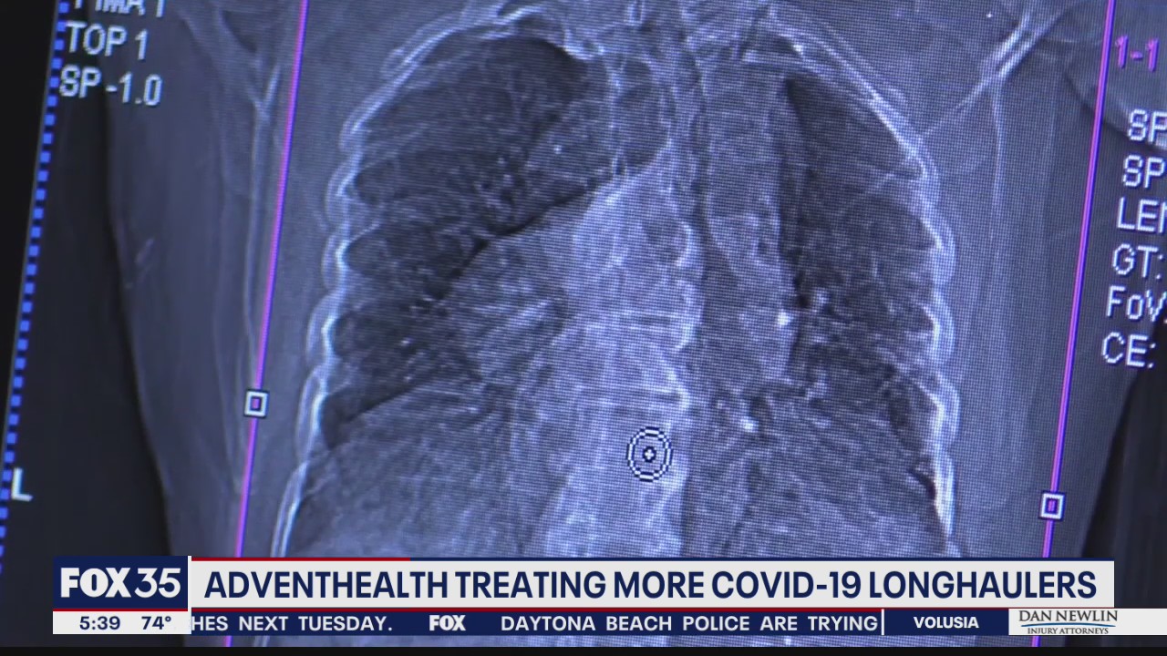 AdventHealth treating more COVID-19 longhaulers