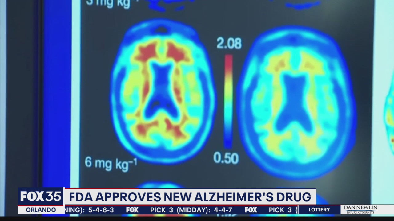 FDA approves Biogen's Alzheimer's drug