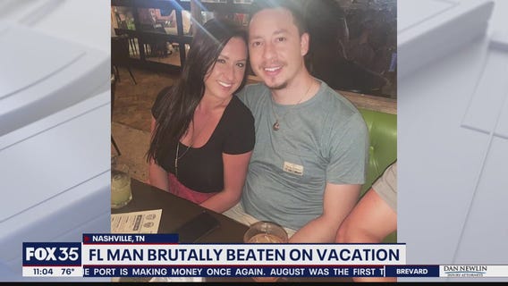Florida man brutally beaten while vacationing in Nashville