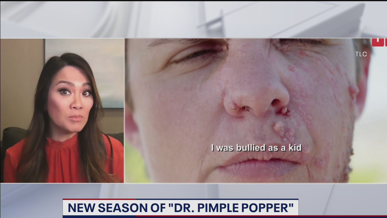 Dr. Pimple Popper talks new season of TLC show