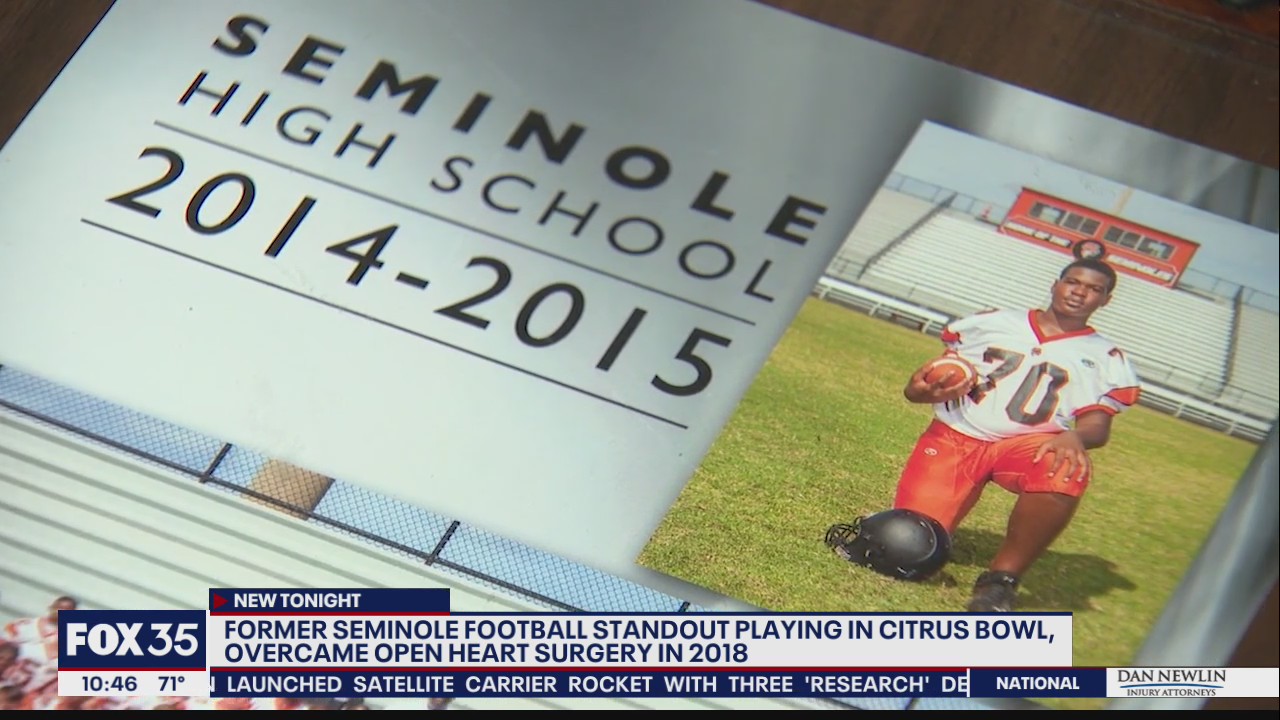 Kentucky's Horsey a former Seminole football player who beat obstacles to return to field