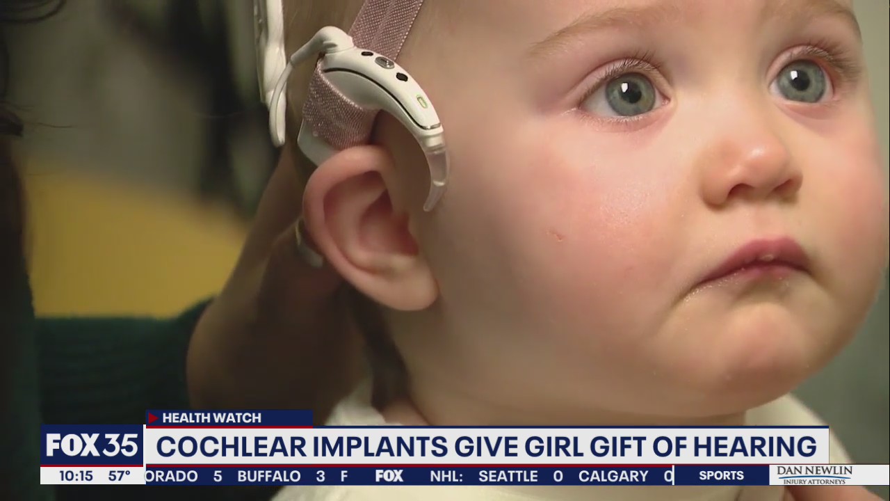 Cochlear implants give toddler gift of hearing