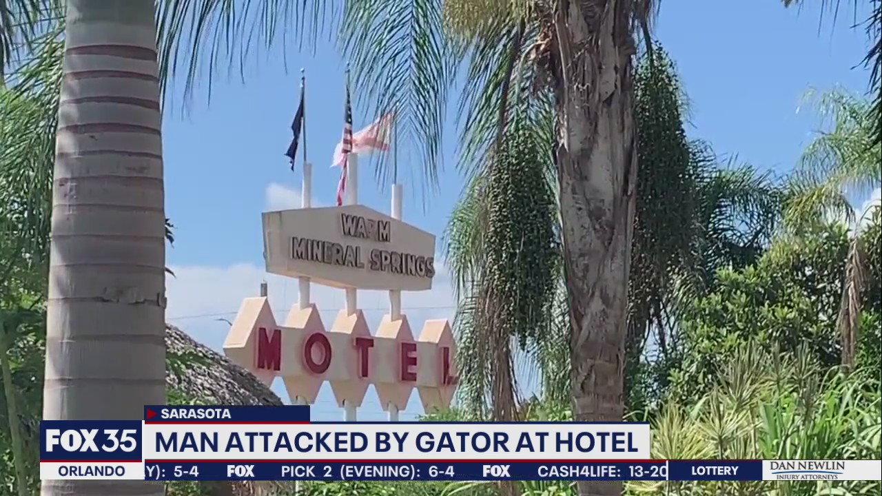 Florida man attacked by alligator at hotel