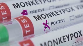 US declares monkeypox outbreak a public health emergency