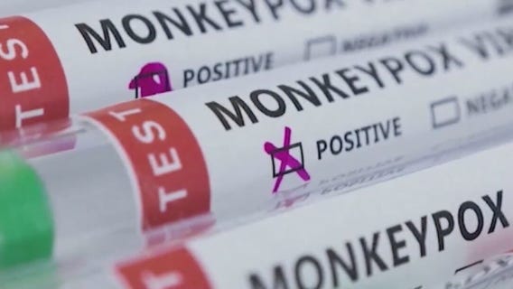 US declares monkeypox outbreak a public health emergency