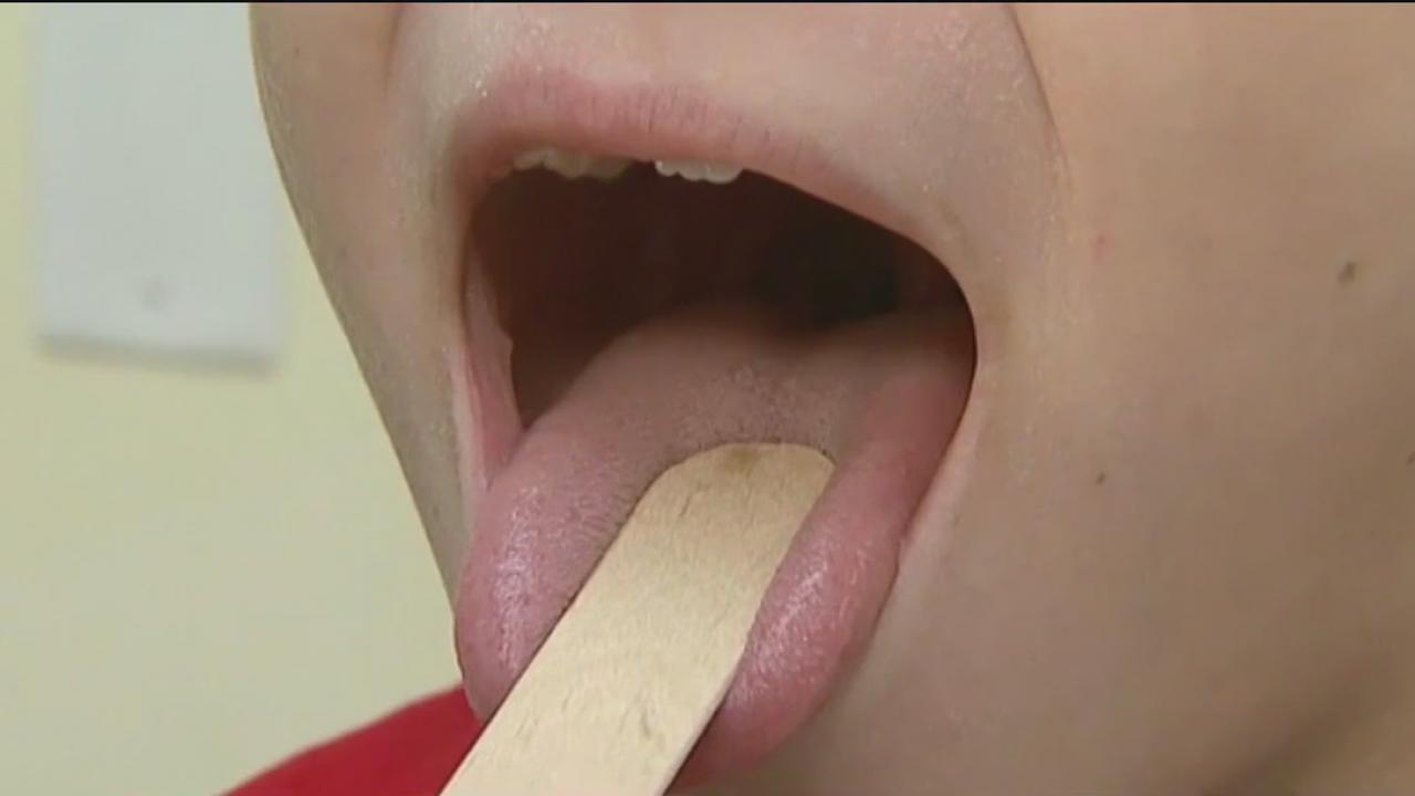 Doctors warn of deadly side effects to strep infection