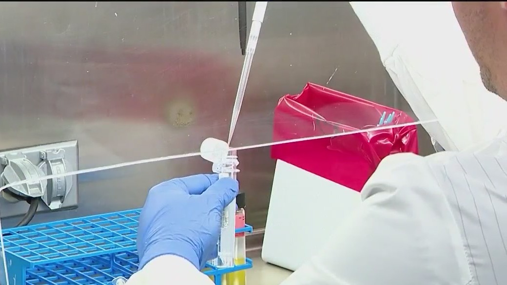 Doctors develop faster brain-eating amoeba test