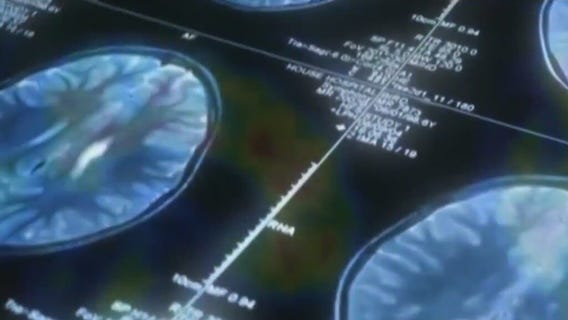 Alzheimer's drug Leqembi could help families