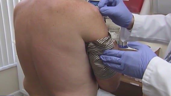 Leprosy cases rising in Brevard County