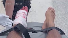 Shark bite victim ready to surf again