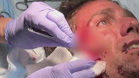 Florida man comes face to face with shark