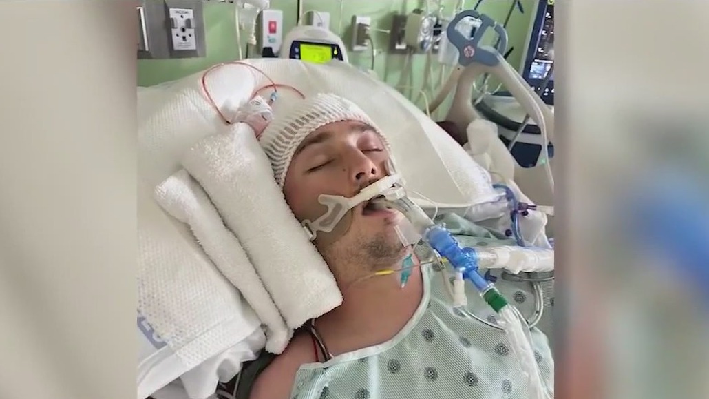 Man loses half of his skull in skateboard accident