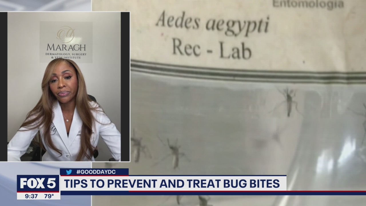 Tips for preventing and treating bug bites