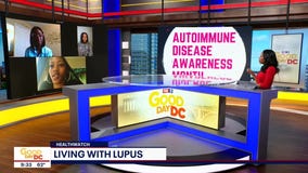 Living with Lupus