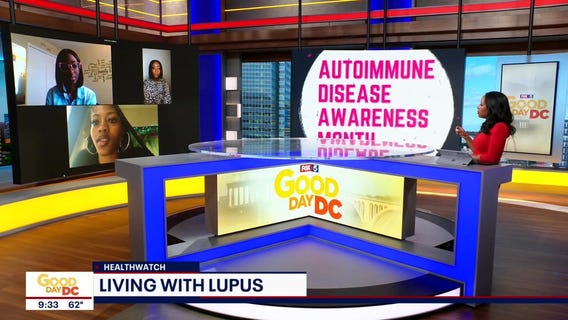 Living with Lupus