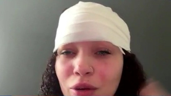 Florida woman recovering after being stabbed by stranger