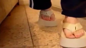 Flip-flop warnings: Are they bad for your feet?