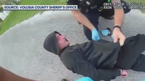 Man hospitalized after being stabbed 11 times