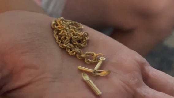 Florida man survives shooting, credits necklace and faith