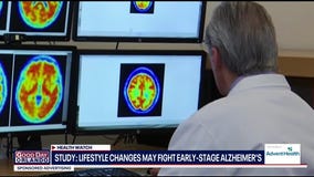 House Calls: The dos and don'ts of brain health