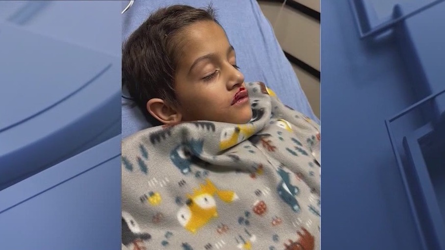 Mom of boy hurt in Lake Eola drone show mishap files lawsuit