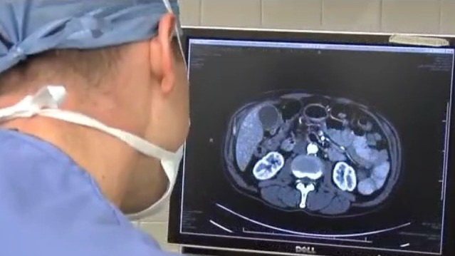 Montell Jordan's cancer is back: What should men look for?