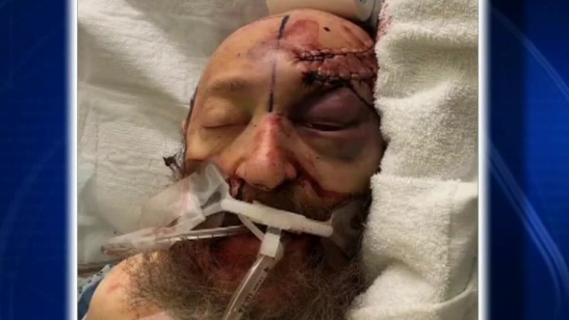 Family of Hanukkah attack victim speak out against bigotry