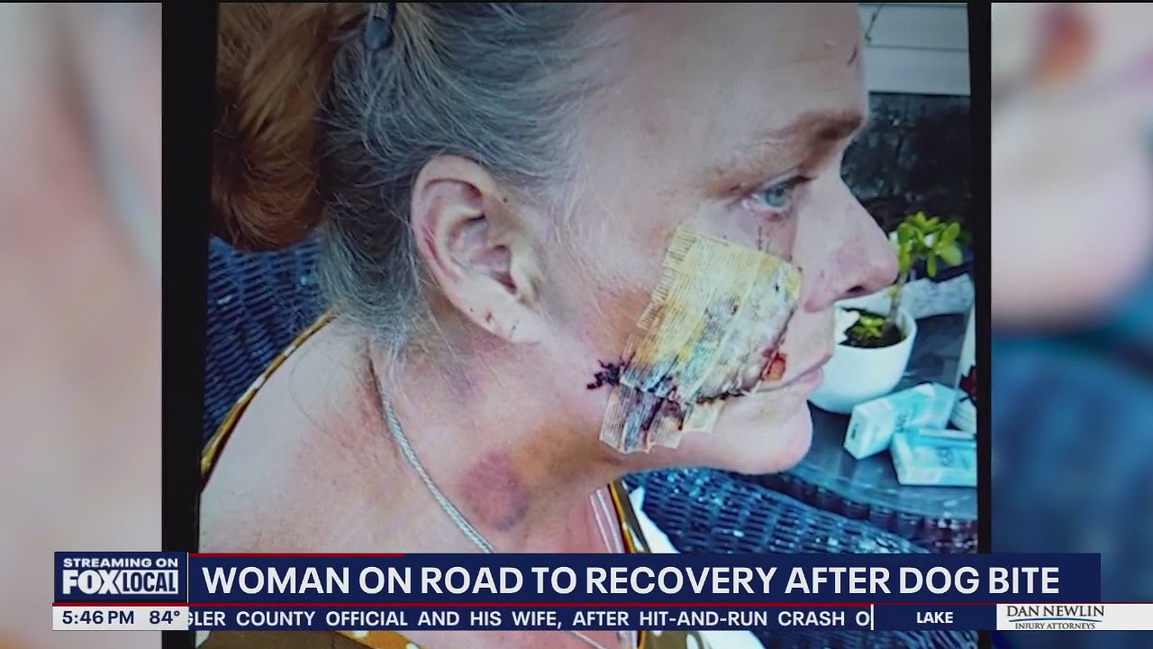 Caregiver recovering after dog mauling in Cocoa | FOX 35 Orlando