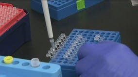 Antibody test limitations