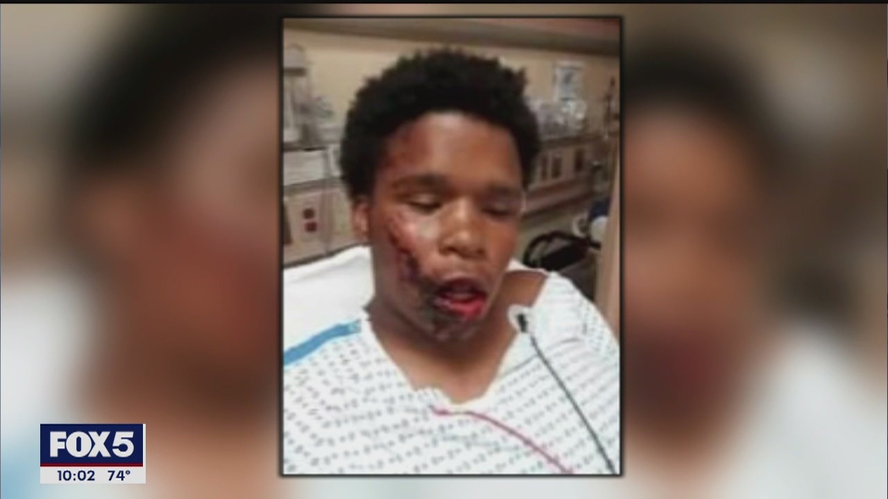 Family of Bronx teen allegedly brutalized by NYPD calls for justice