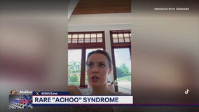 "Achoo" syndrome: do you have it?