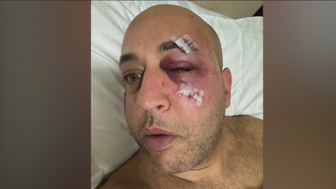 NYPD Lieutenant assaulted in NYC subway