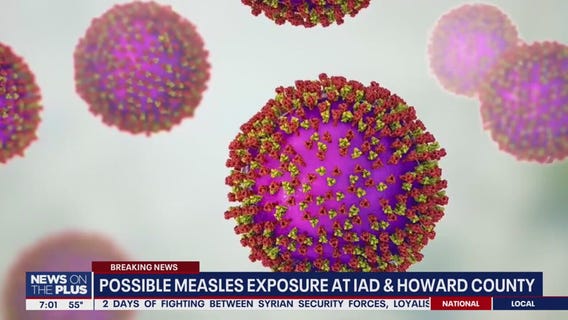 Measles exposure traced to Dulles Airport, Howard County