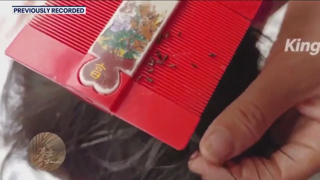 Lice is back, here's how to get rid of them