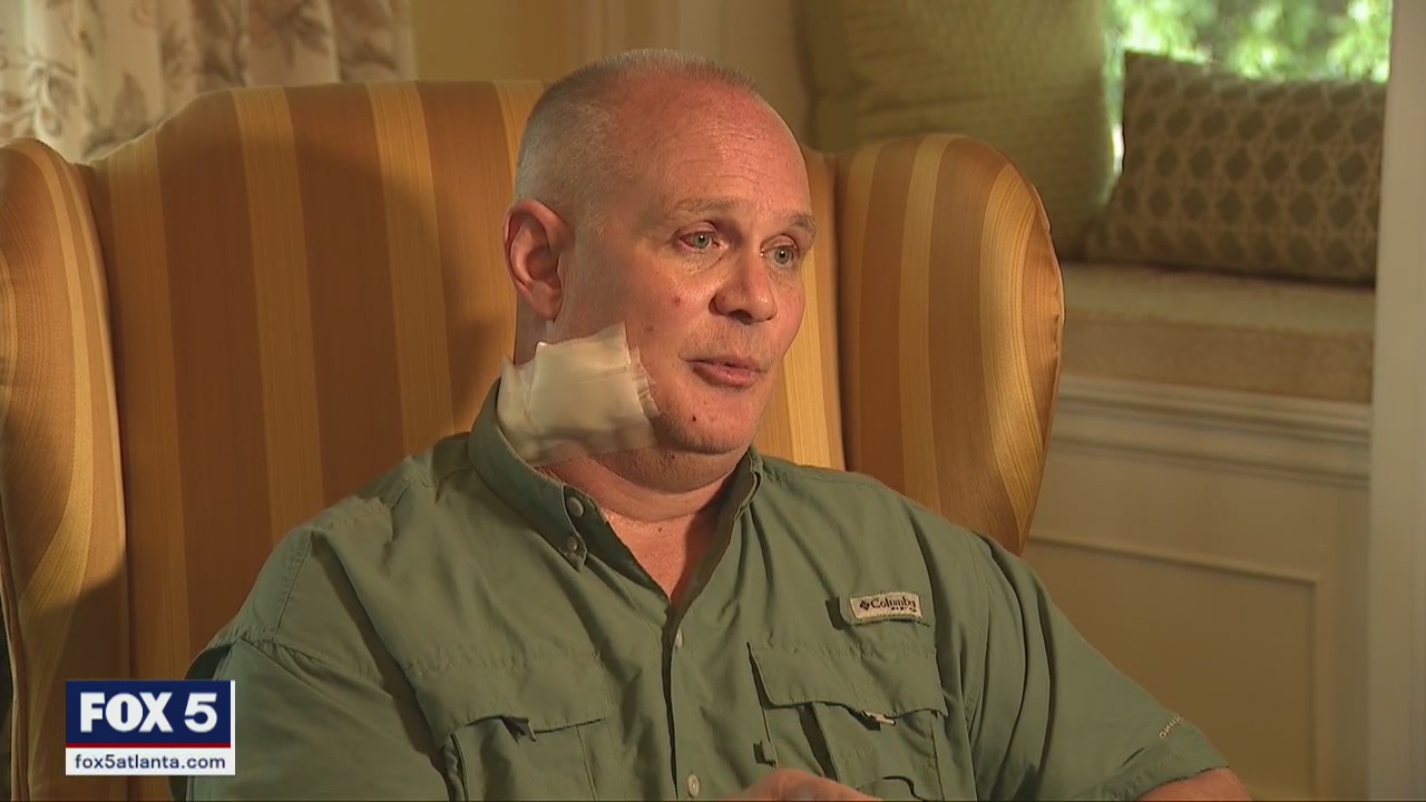 Officer recovering after being shot | FOX 5 Atlanta