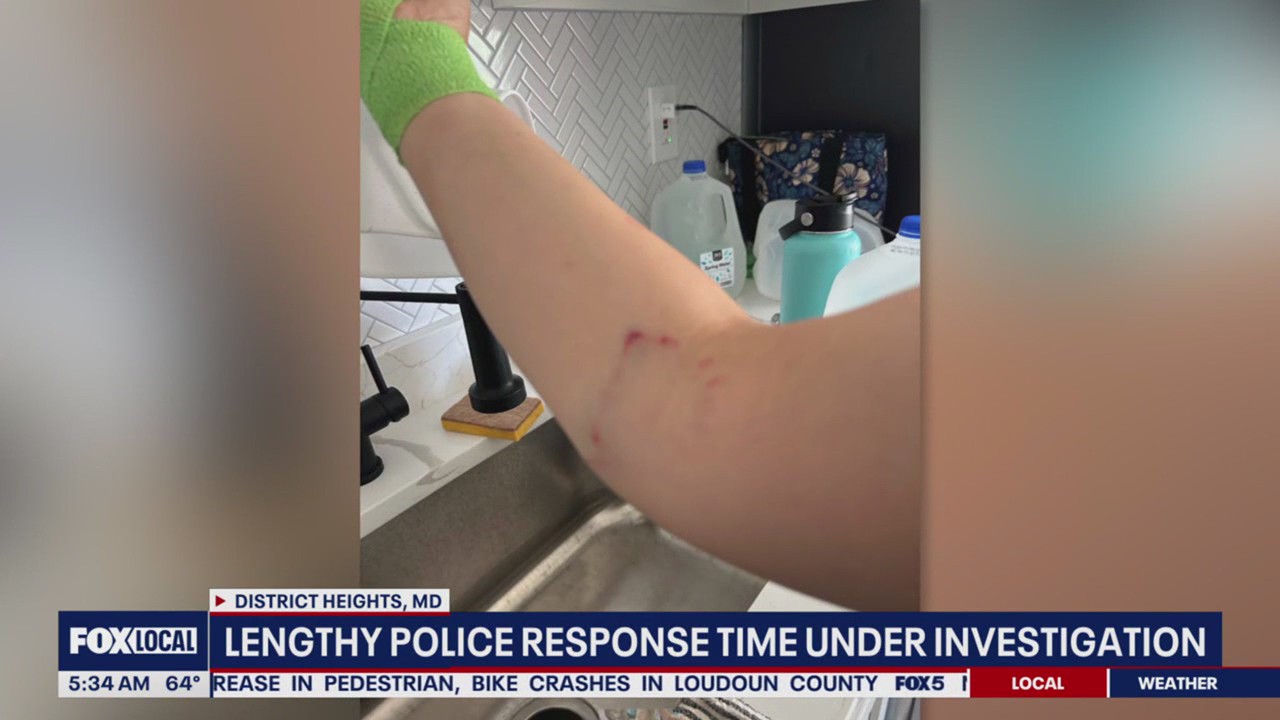Police response time under investigation following dog attack | FOX 5 DC