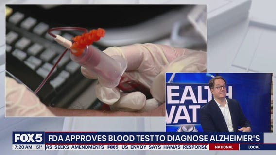 Sunday Health Advisor Talks Alzheimer?s and Brain Health Awareness Month