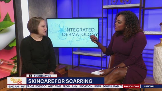 Skincare for scarring