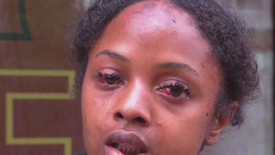 UDC student athlete attacked on campus