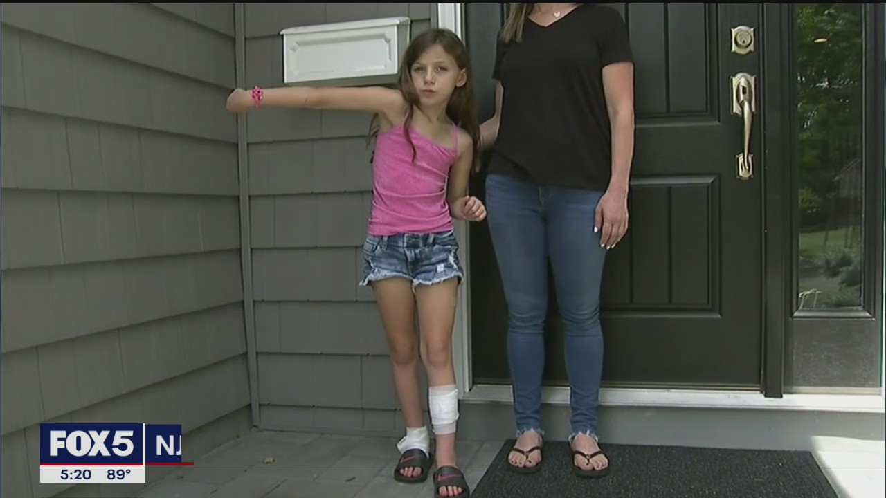 8-year-old girl bitten by fox in New Jersey